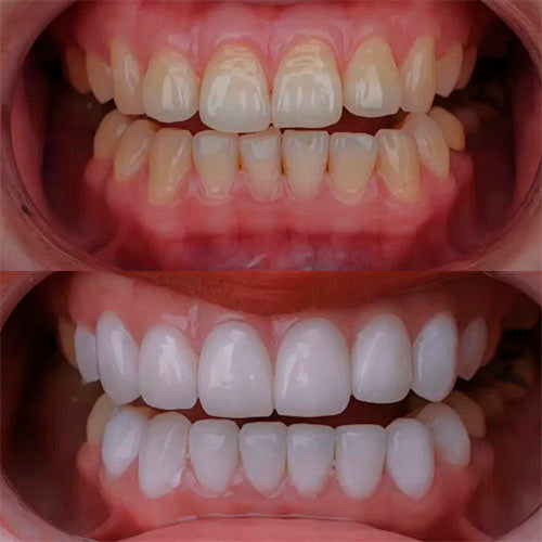7 Reasons Why Professionals Are Switching to Radiant Whitening Toothpaste