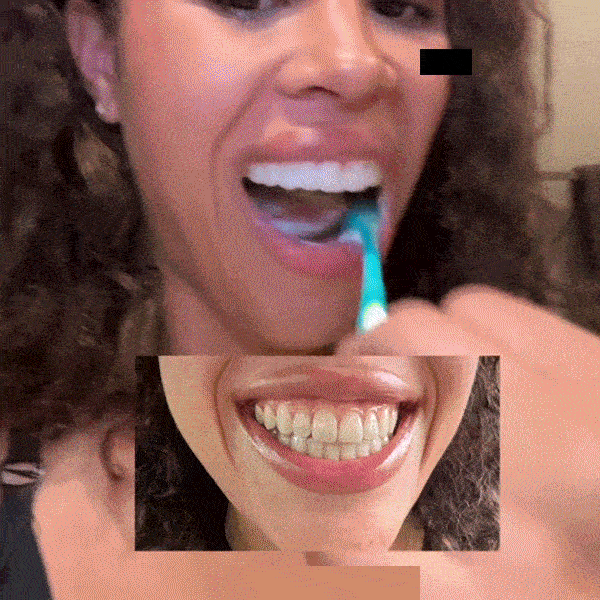 7 Reasons Why Professionals Are Switching to Radiant Whitening Toothpaste