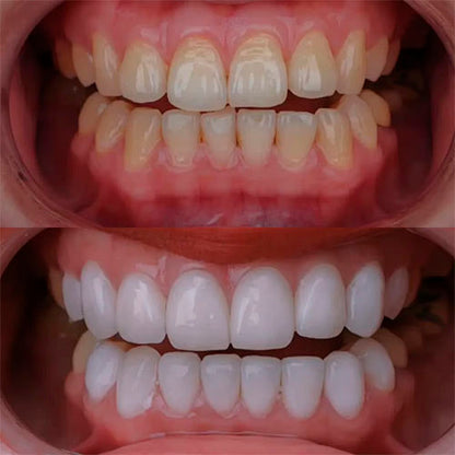 7 Reasons Why Professionals Are Switching to Radiant Whitening Toothpaste