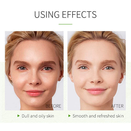 Green Tea Bubbles - Masks to Eliminate Blackheads