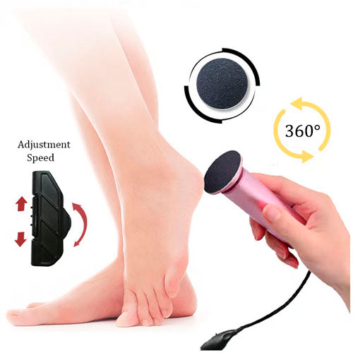 🔥Electric Foot Callus Remover