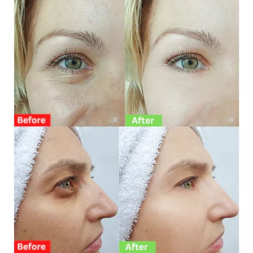 Anti-Aging Eye Cream For All Skin