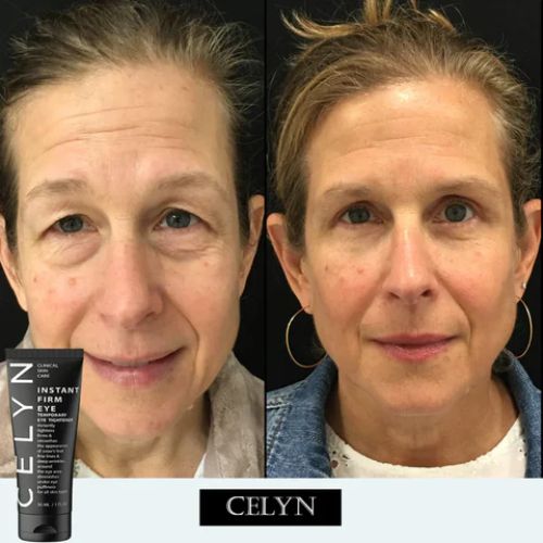 Anti-Aging Eye Cream For All Skin