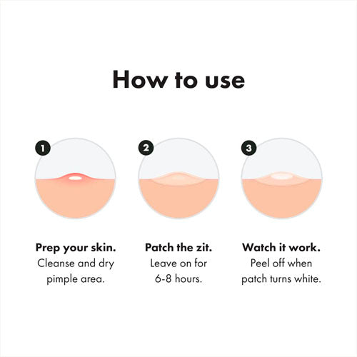 Hydrocolloid Acne Patch to Cover Pimples and Blemishes