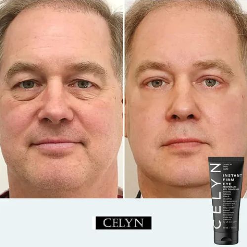 Anti-Aging Eye Cream For All Skin
