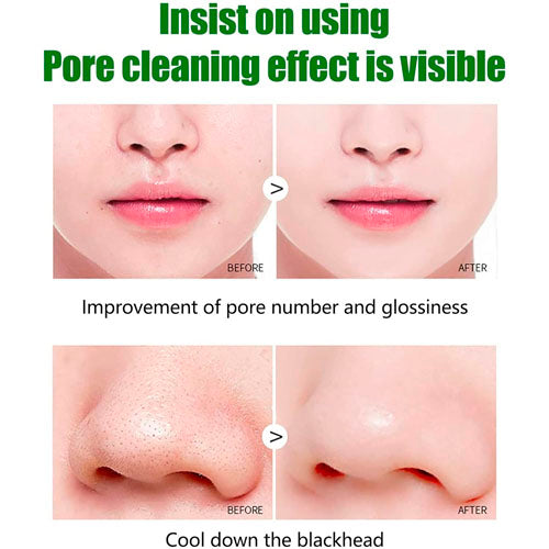 Green Tea Bubbles - Masks to Eliminate Blackheads