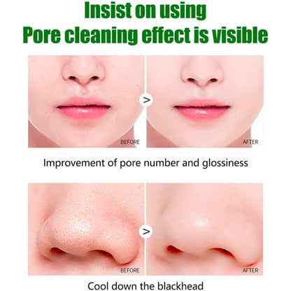 Green Tea Bubbles - Masks to Eliminate Blackheads