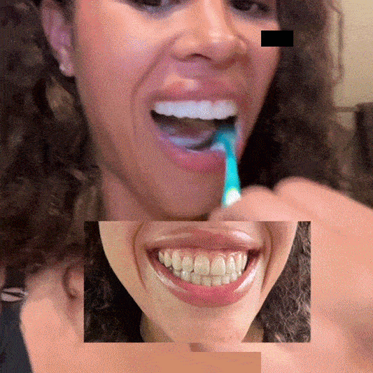 7 Reasons Why Professionals Are Switching to Radiant Whitening Toothpaste