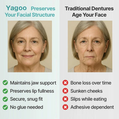 "🎁Ends Today: 70% OFF! ⏰Yagoo™ Medical Full Denture with Strong Suctiond🦷Obtain American Dental Association (ADA) Certification